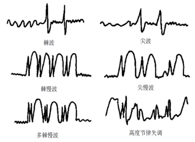 直播回顾 | 《电生理技术在CNS药物研发中的应用及转化意义》(图4)